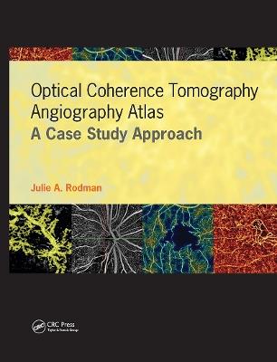 Optical Coherence Tomography Angiography Atlas: A Case Study Approach - Julie A. Rodman - cover