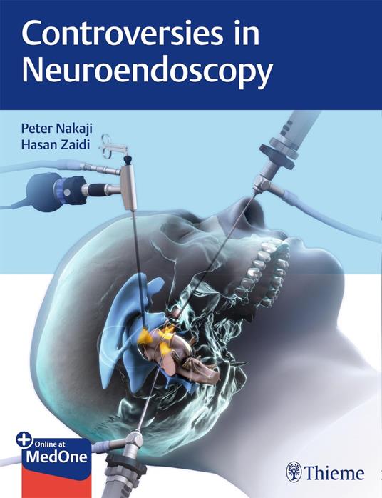 Controversies in Neuroendoscopy