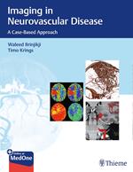 Imaging in Neurovascular Disease