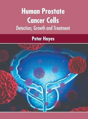 Human Prostate Cancer Cells: Detection, Growth and Treatment - cover