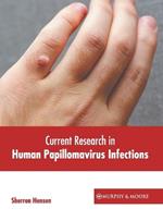 Current Research in Human Papillomavirus Infections