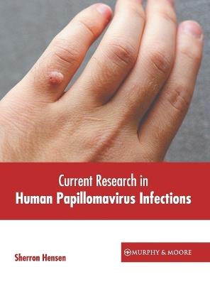 Current Research in Human Papillomavirus Infections - cover