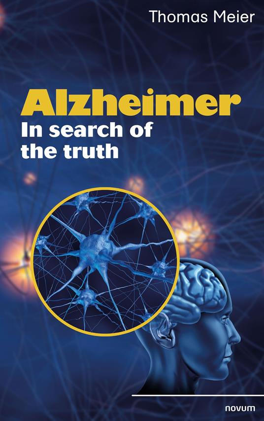 Alzheimer - In search of the truth