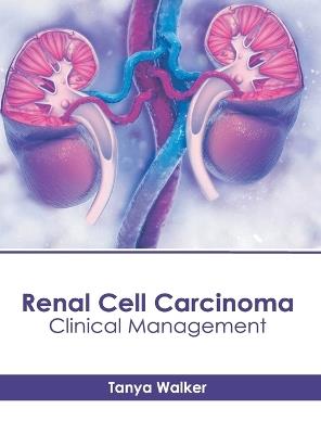 Renal Cell Carcinoma: Clinical Management - cover