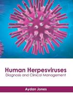 Human Herpesviruses: Diagnosis and Clinical Management