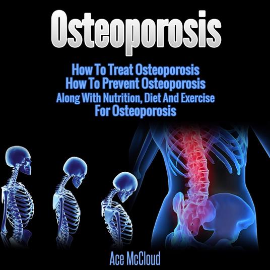 Osteoporosis: How To Treat Osteoporosis: How To Prevent Osteoporosis: Along With Nutrition, Diet And Exercise For Osteoporosis