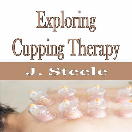 Exploring Cupping Therapy