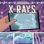 X-Rays