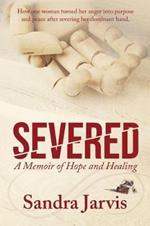 Severed: A Memoir of Hope and Healing