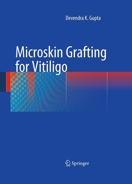 Microskin Grafting for Vitiligo