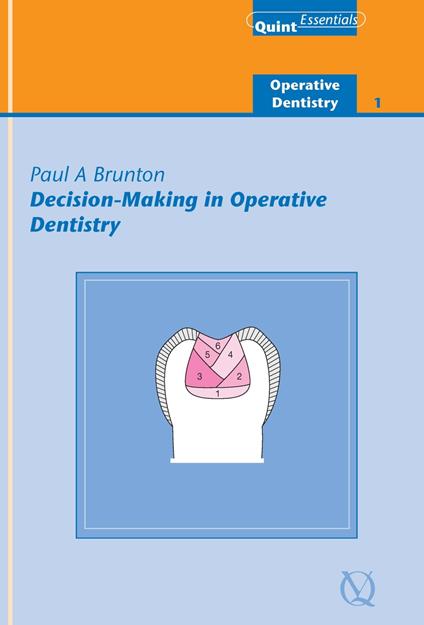 Decision-Making in Operative Dentistry