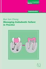 Managing Endodontic Failure in Practice