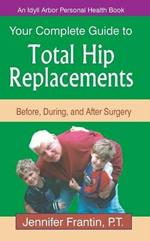 Your Comp GT Total Hip Replace: Before, During, and After Surgery