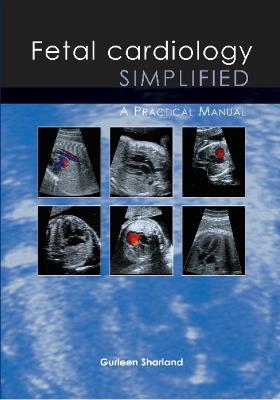 Fetal Cardiology Simplified: A Practical Manual - cover