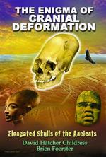 Enigma of Cranial Deformation: Elongated Skulls of the Ancients