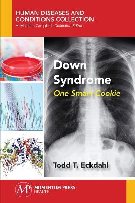 Down Syndrome: One Smart Cookie - Todd T Eckdahl - cover