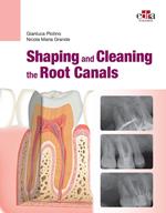 Shaping and Cleaning the Root Canals