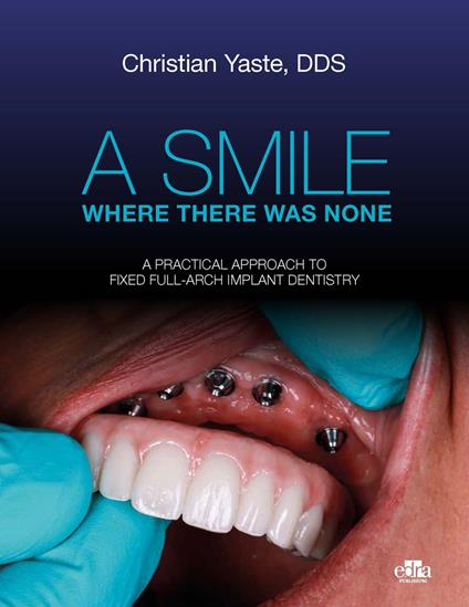 A smile where there was none. A pratical approach to fixed full-arch implant dentistry - Christian Yaste - copertina