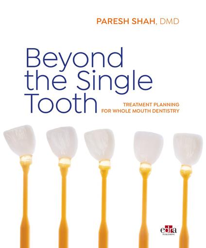 Beyond the Single Tooth. Treatment planning for whole mouth dentistry - Paresh Shah - copertina