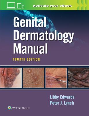 Genital Dermatology  Manual - Elizabeth Edwards,Peter Lynch - cover