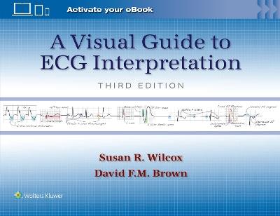 A Visual Guide to ECG Interpretation: Print + eBook with Multimedia - Susan Renee Wilcox,DAVID F. M. BROWN - cover