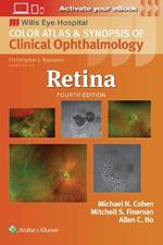 Retina