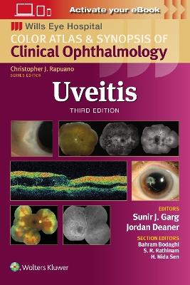 Uveitis - Sunir J. Garg - cover