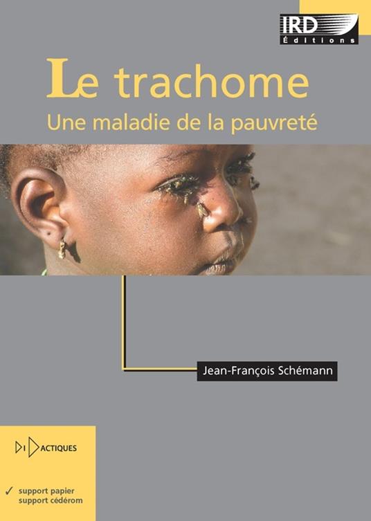Le trachome