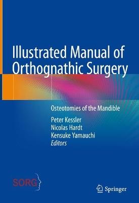 Illustrated Manual of Orthognathic Surgery: Osteotomies of the Mandible - cover