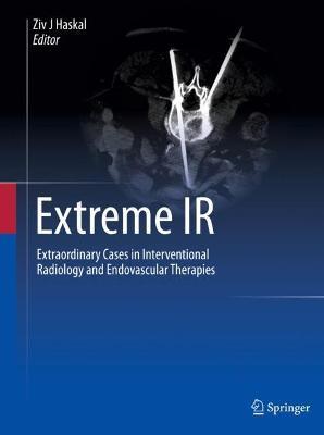 Extreme IR: Extraordinary Cases in Interventional Radiology and Endovascular Therapies - cover