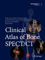 Clinical Atlas of Bone SPECT/CT