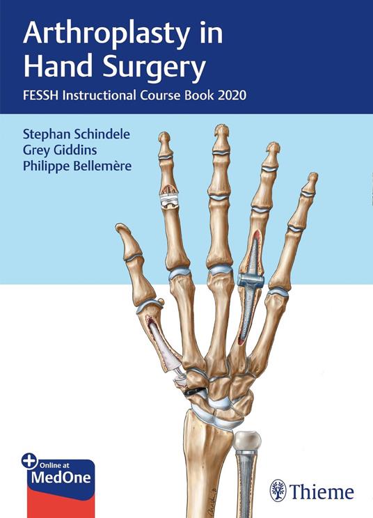 Arthroplasty in Hand Surgery