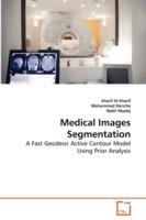 Medical Images Segmentation