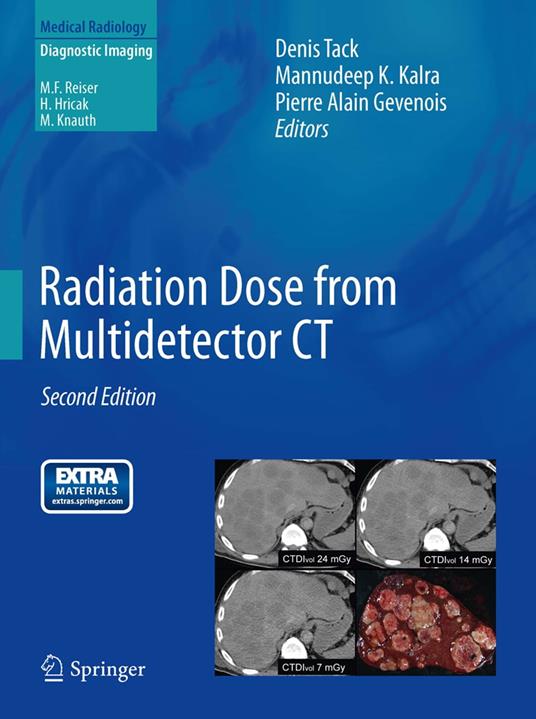 Radiation Dose from Multidetector CT