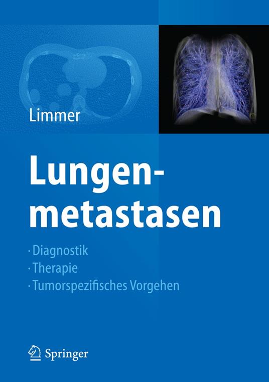 Lungenmetastasen