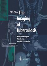 The Imaging of Tuberculosis