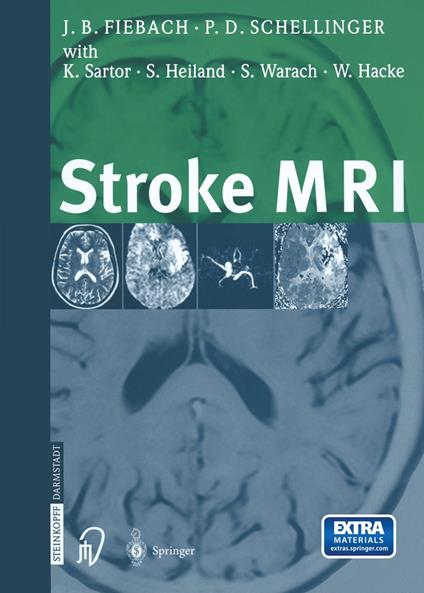 Stroke MRI