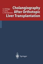 Cholangiography After Orthotopic Liver Transplantation