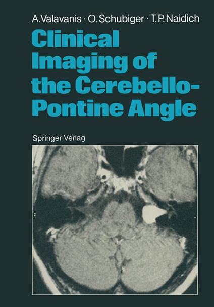 Clinical Imaging of the Cerebello-Pontine Angle