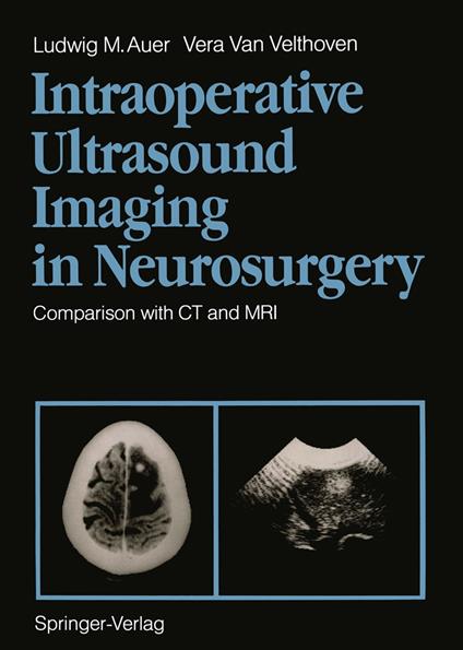 Intraoperative Ultrasound Imaging in Neurosurgery