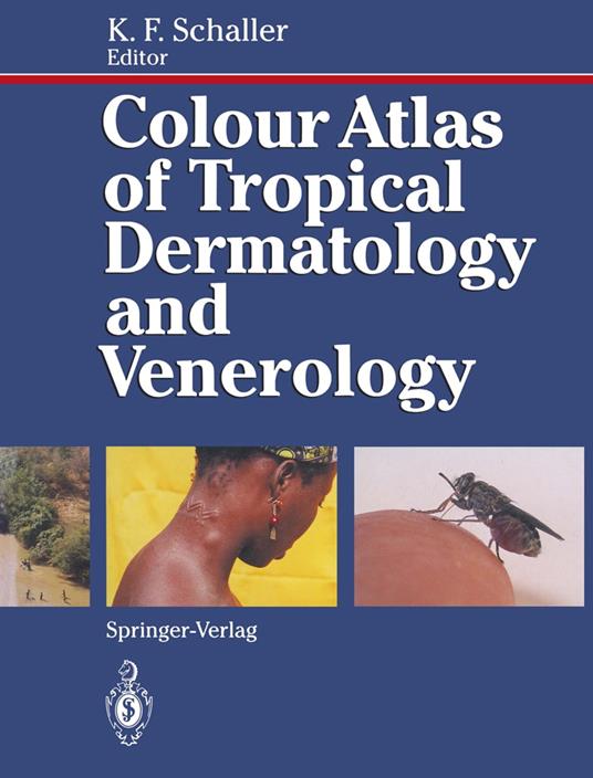 Colour Atlas of Tropical Dermatology and Venerology