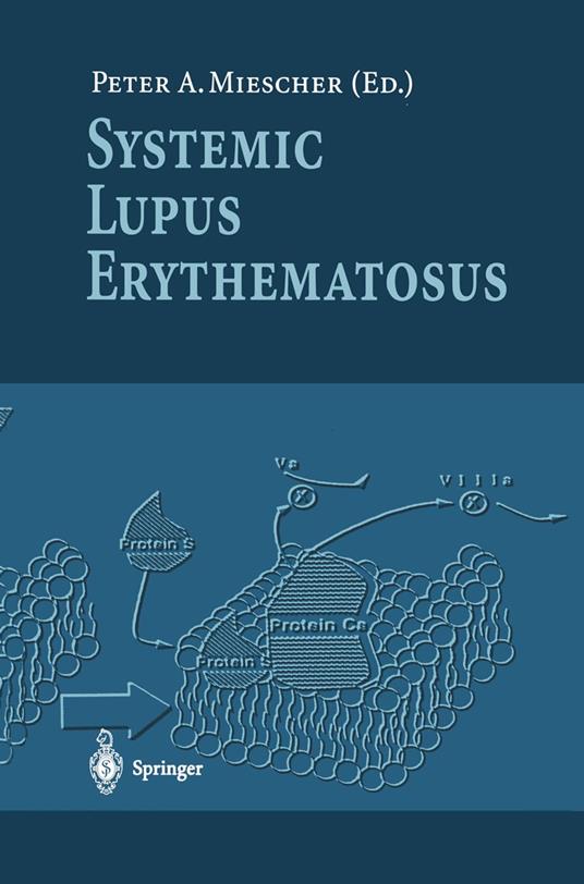 Systemic Lupus Erythematosus