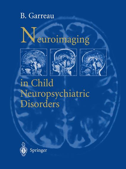 Neuroimaging in child neuropsychiatric disorders