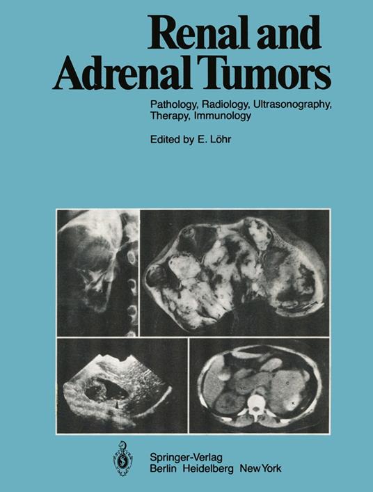 Renal and Adrenal Tumors