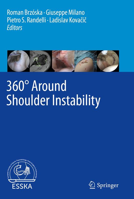 360° Around Shoulder Instability