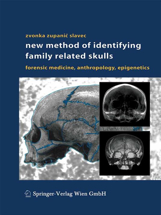 New Method of Identifying Family Related Skulls