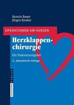 Herzklappenchirurgie: Ein Patientenratgeber