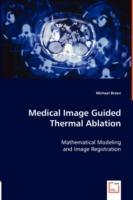 Medical Image Guided Thermal Ablation