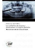 Les cellulites de l'espace masticateur d'origine dentaire - Moussaoui Eya,Maryem Kerkeni - cover