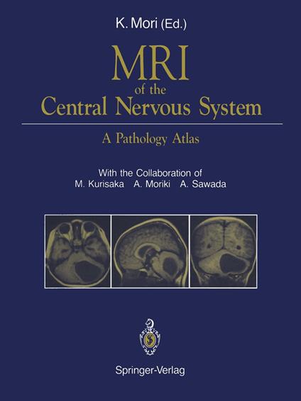 MRI of the Central Nervous System